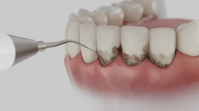 Trusted Invisalign Clear Aligners service in South Chicago Heights, IL - Dentist Open Now